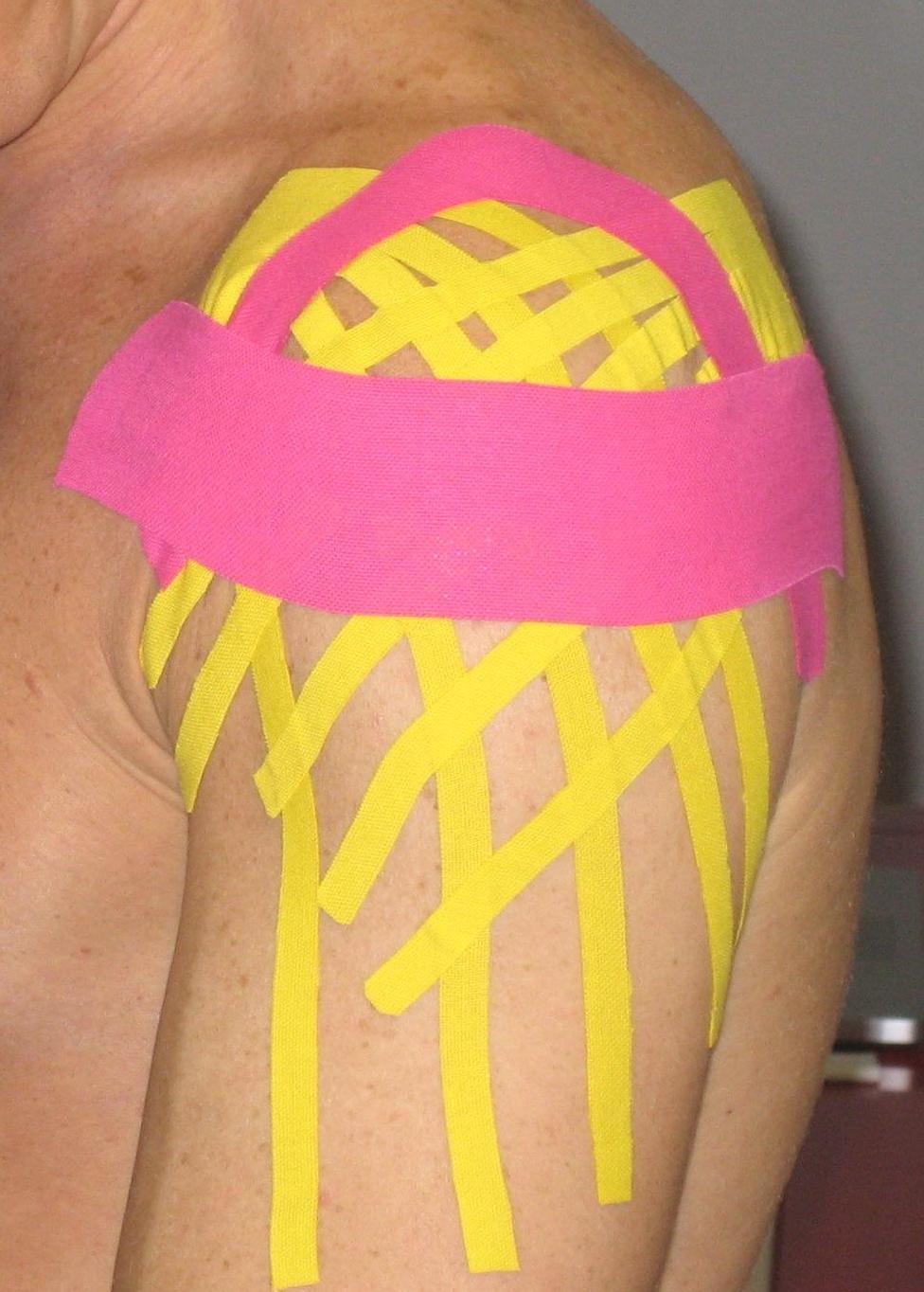 IL TAPING DRENANTE E PROPRIOCETTIVO - TDP