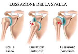 articolazione della spalla