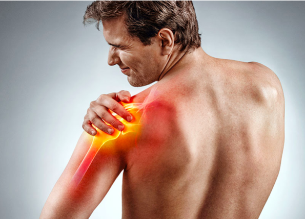 discinesia spalla dolore muscolare