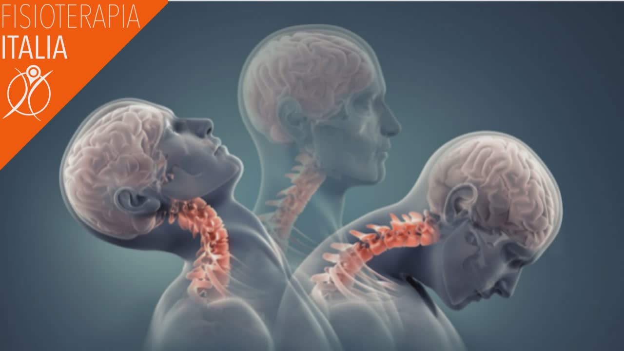 cause della vertigine cervicale