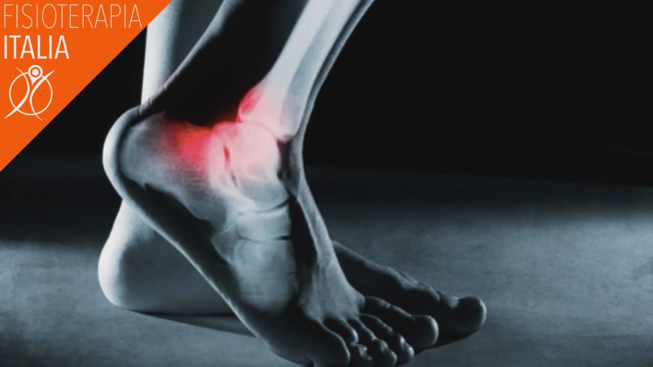 caviglie gonfie cause distorsione