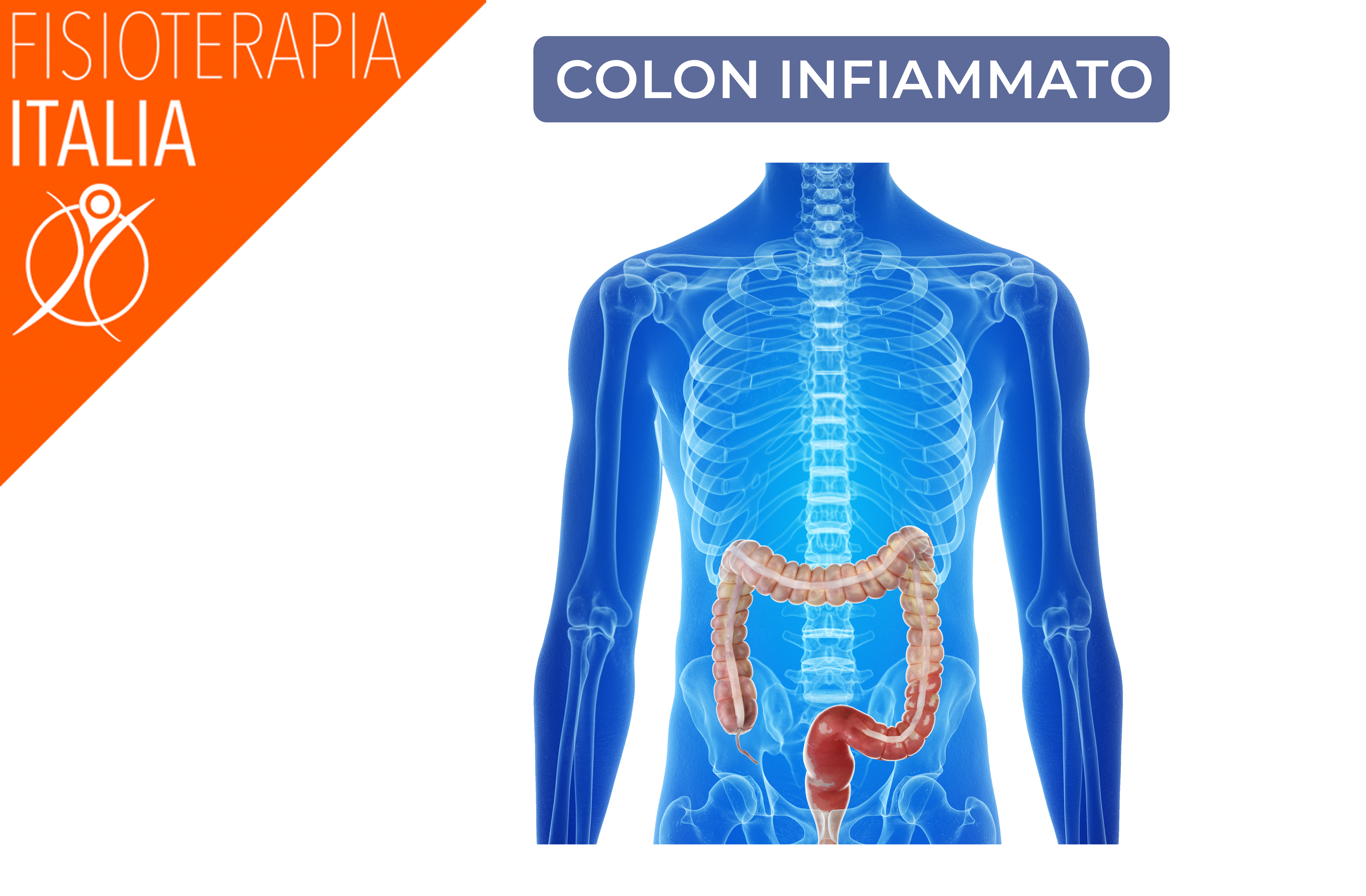 colon infiammato e mal di schiena