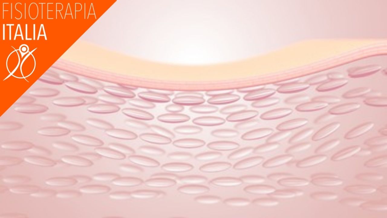 come auta Ła radiofrequenza