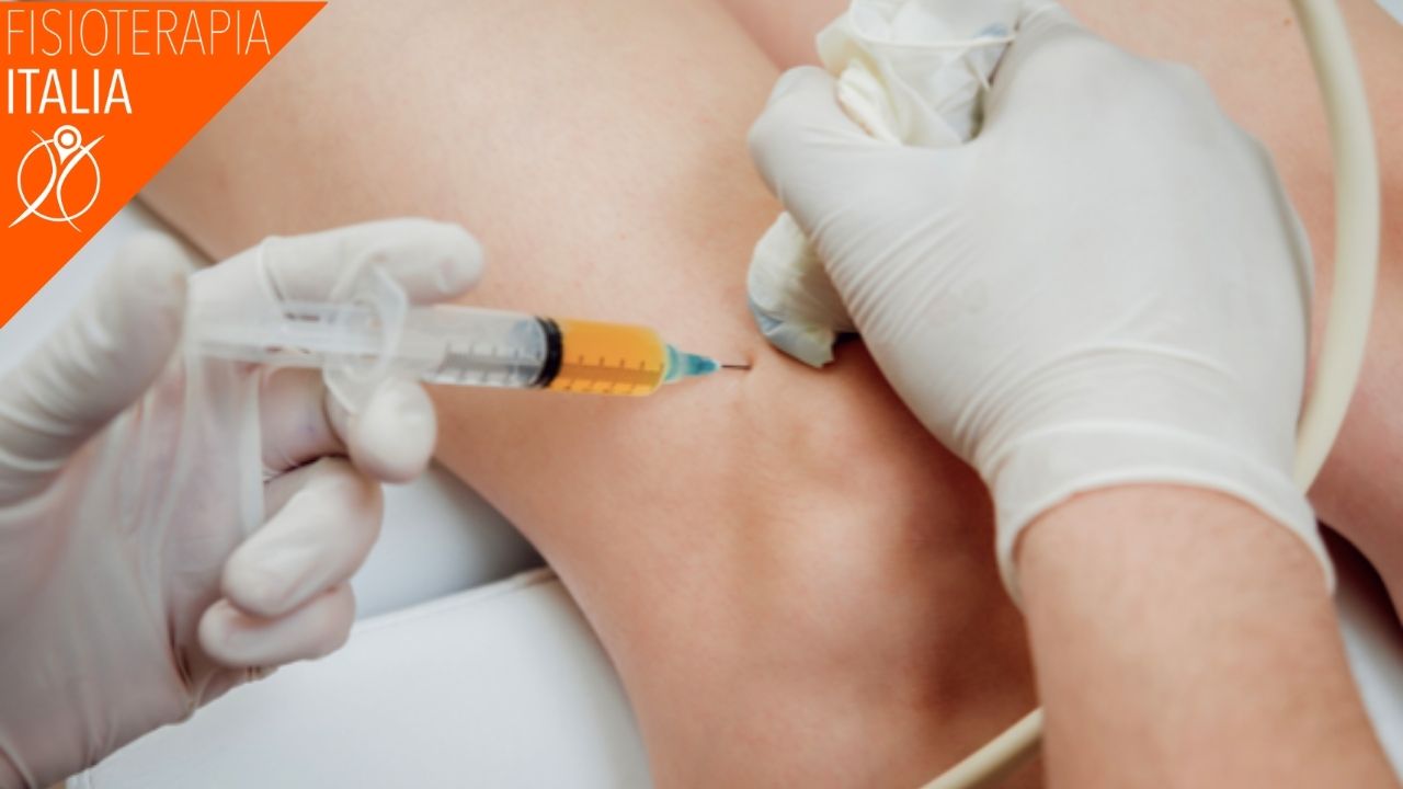 condropatia rotula infiltrazioni e cure