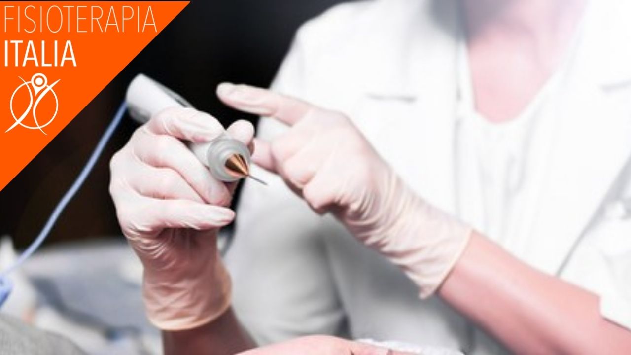 crioterapia localizzata