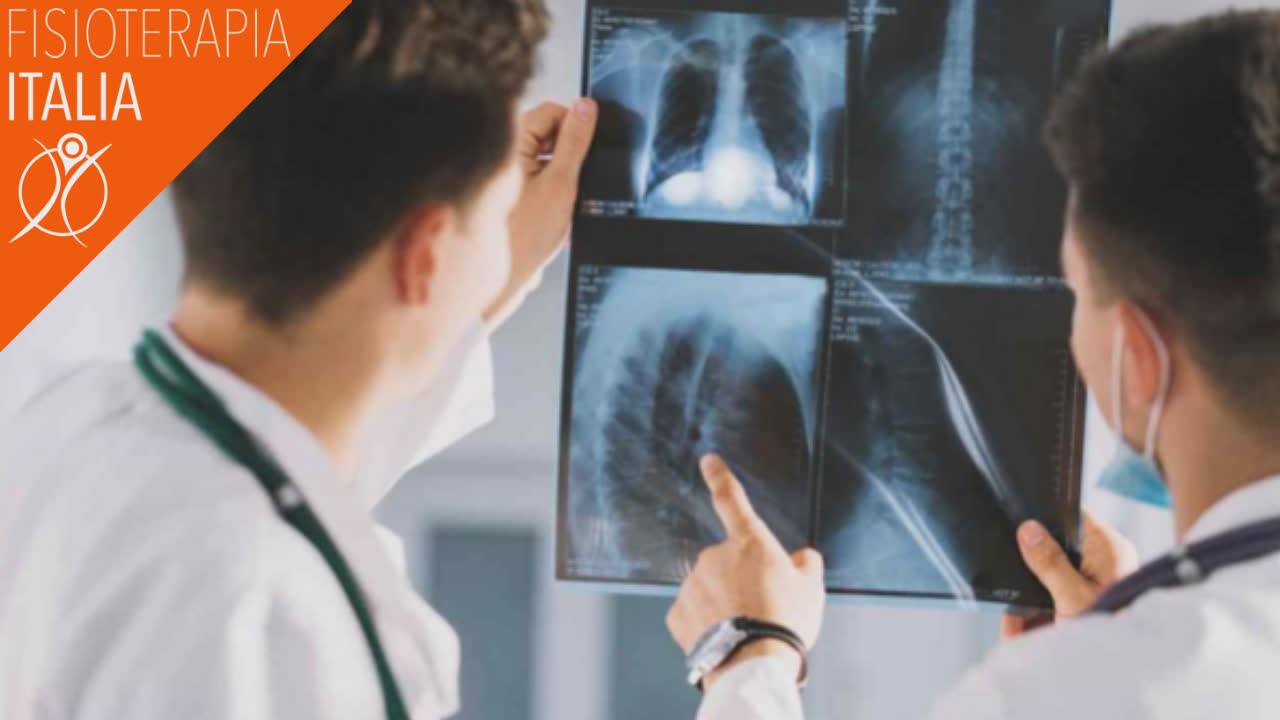 dolore al fianco sinistro splenomegalia