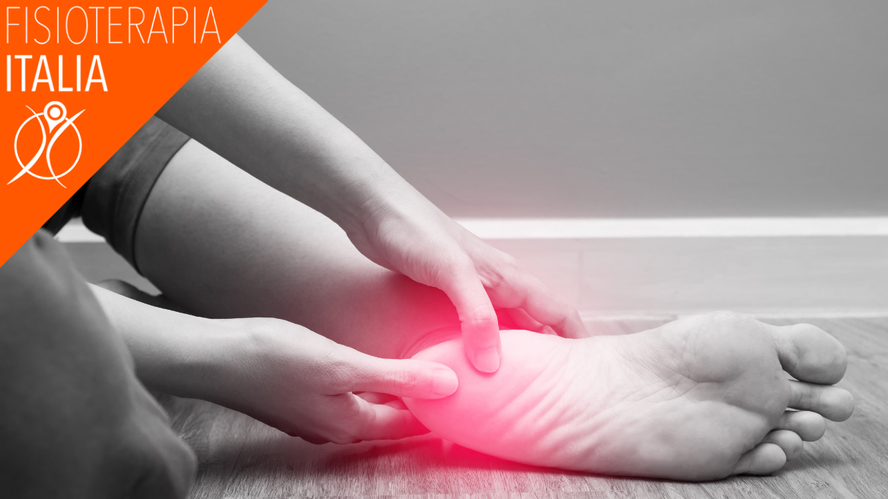 fascite plantare come viene