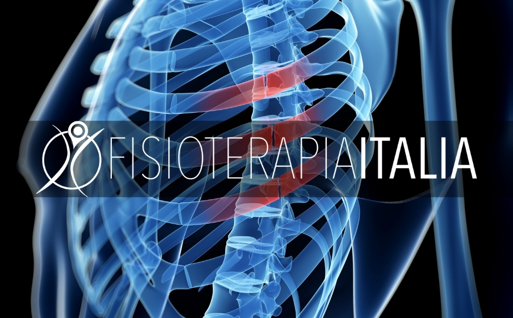 Frattura delle costole cosa fare e tempi di recupero