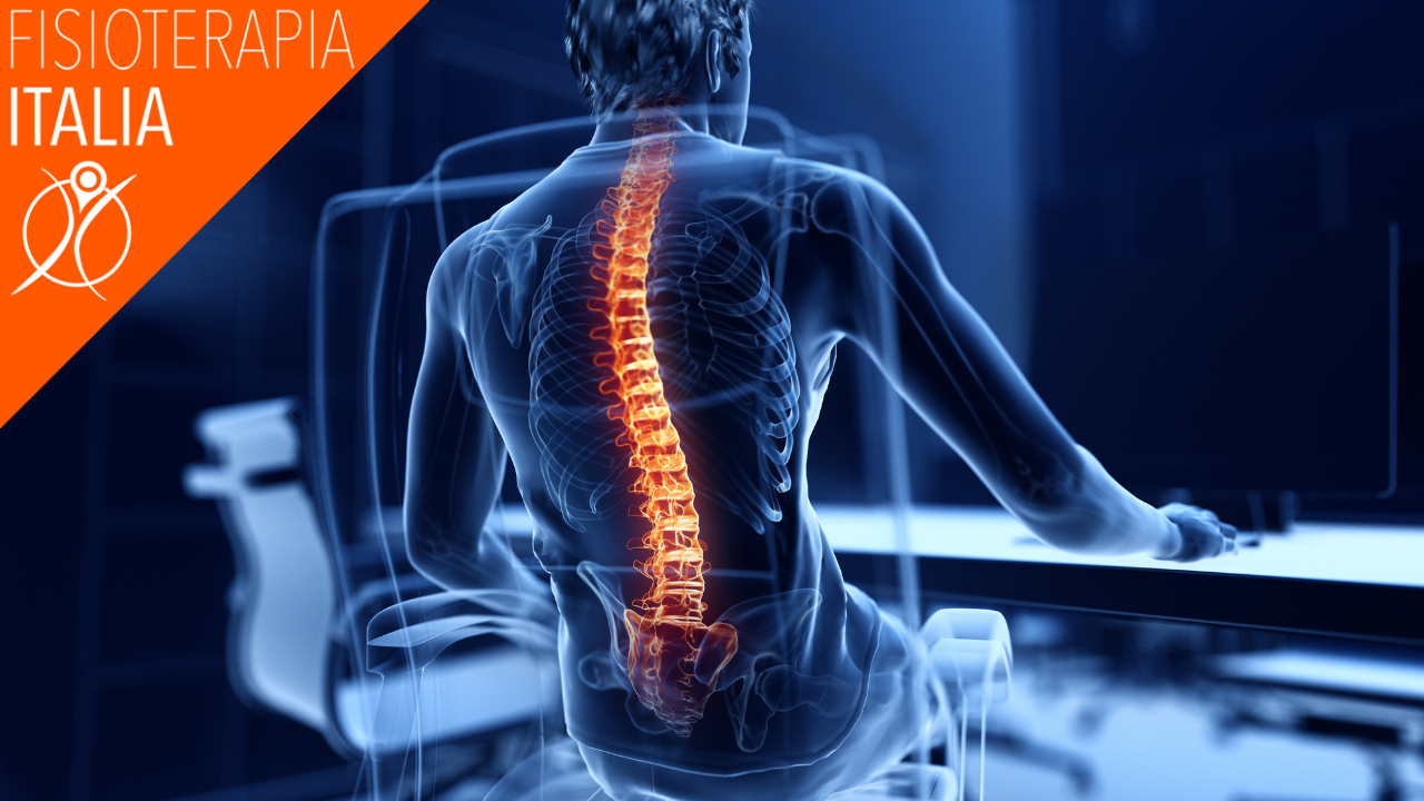 mal di schiena postura scorretta rimedi