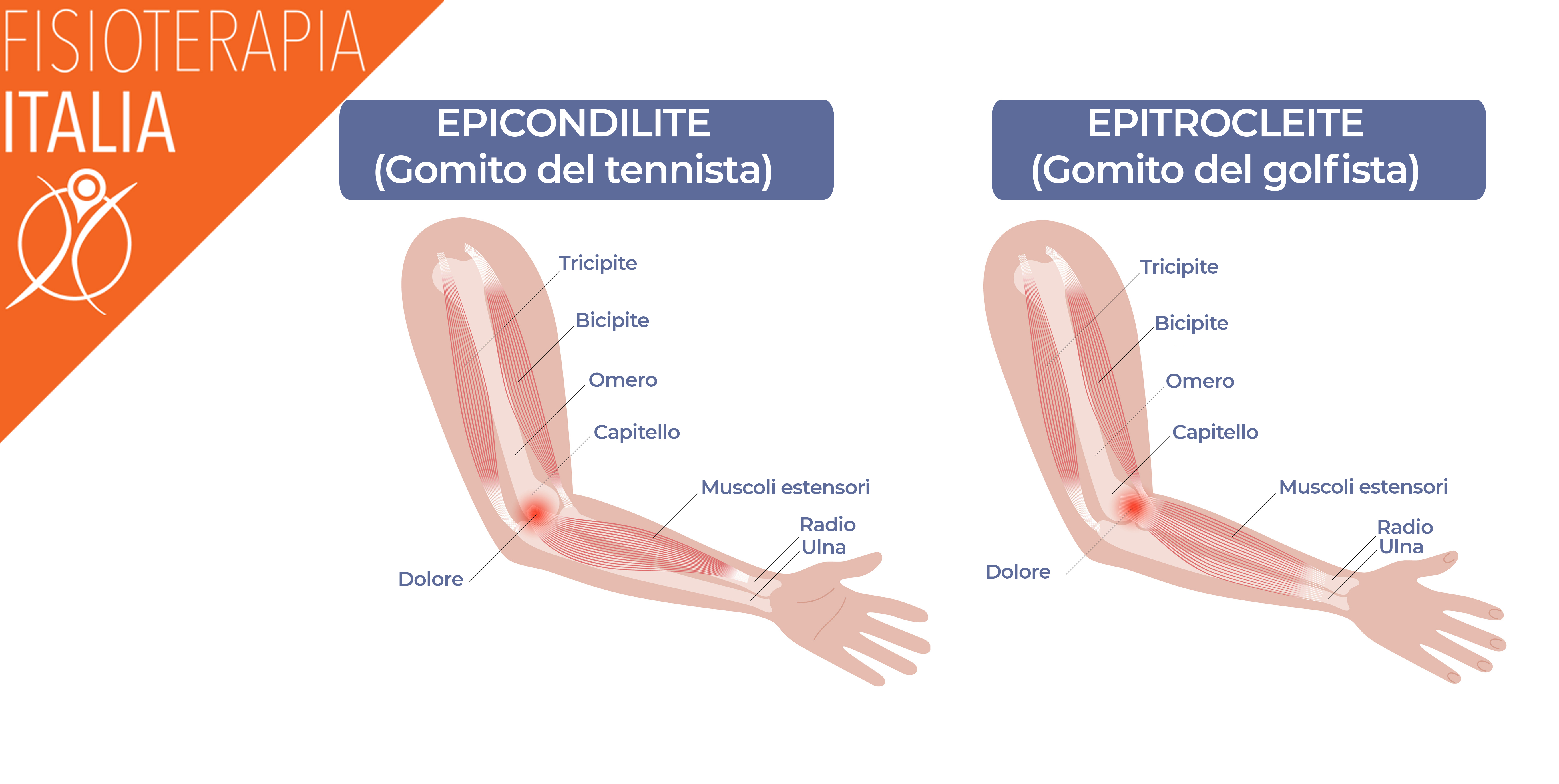 patologie del gomito