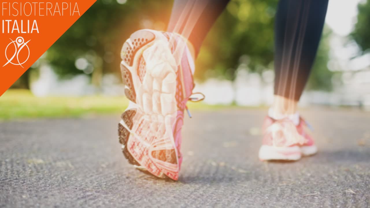 sindrome tunnel tarsale