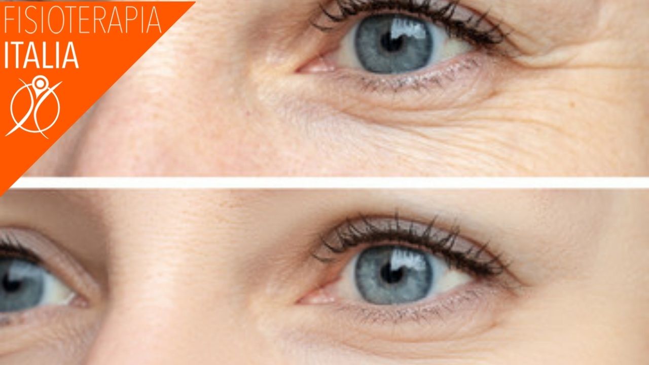 strumenti della radiofrequenza