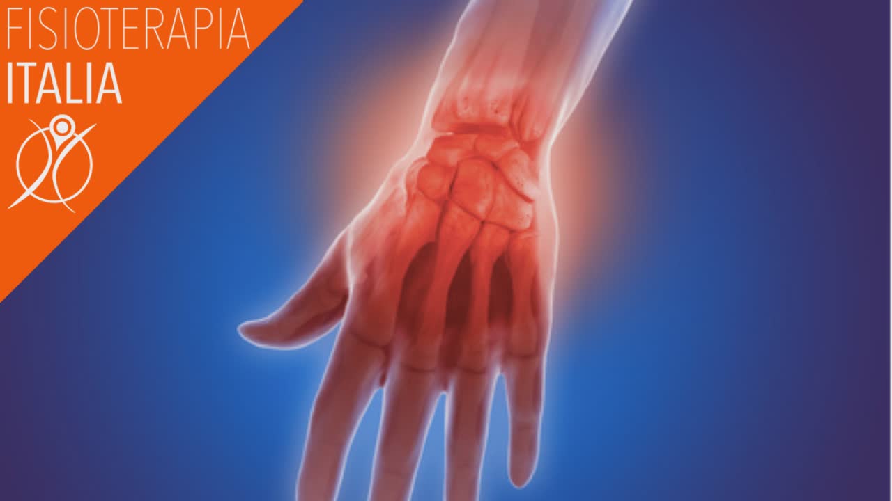 artrosi e rizoartrosi della mano cosa sono