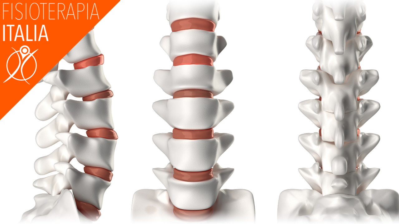 artrosi lombare anatomia colonnaù