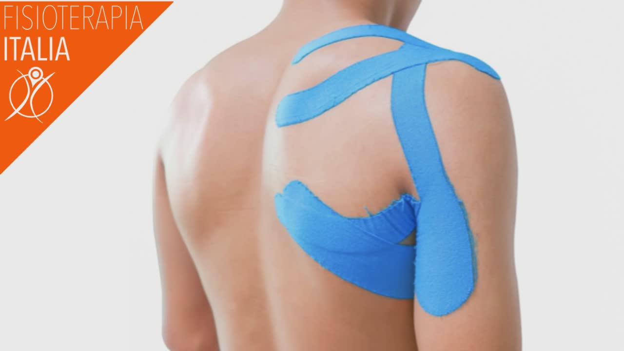 bendaggio funzionale spalla
