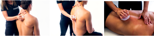 cupping massage per il trattamento della fascia