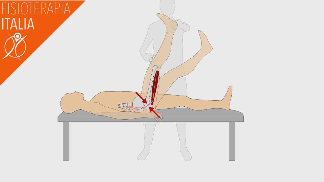 diagnosi lombosciatalgia esegue