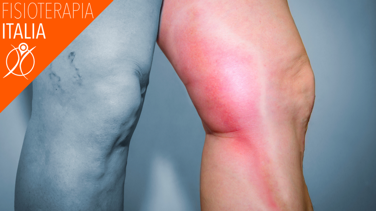 dolore alle gambe patologie