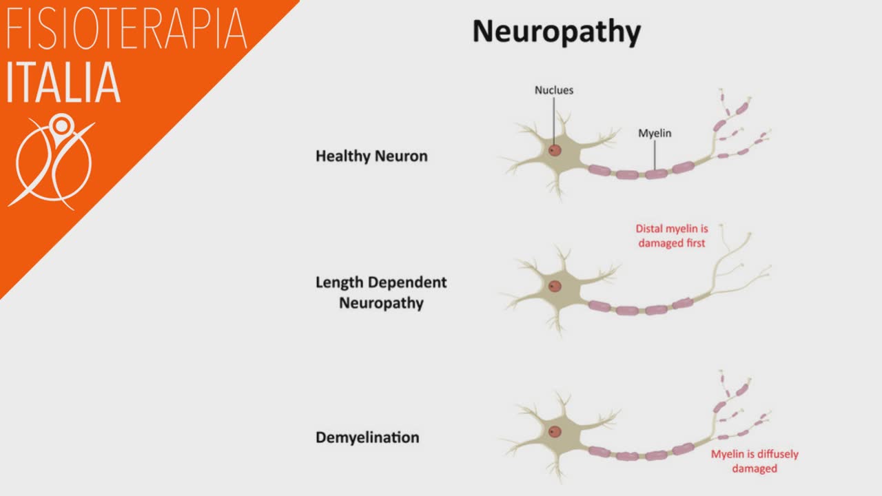 dolore cronico neuropatico cosa viene danneggiato