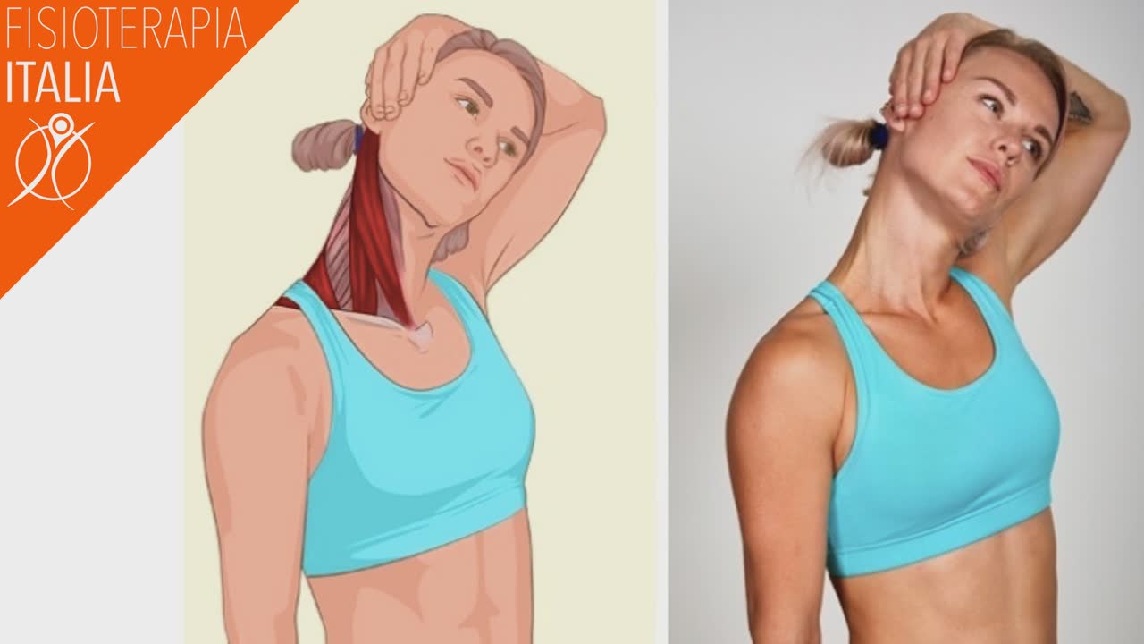 esercizi sternocleidomastoideo cosa fare
