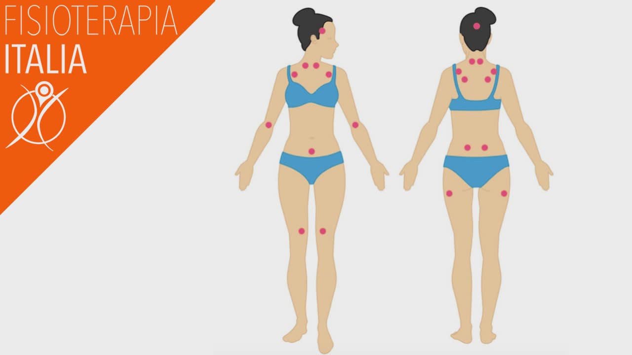 fibromialgia i sintomi