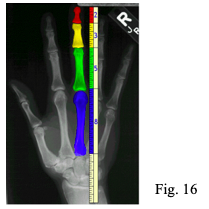 fig 16