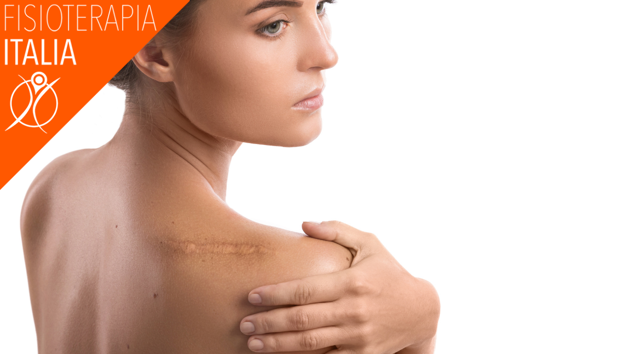 fisioterapia dermatofunzionale applicazioni