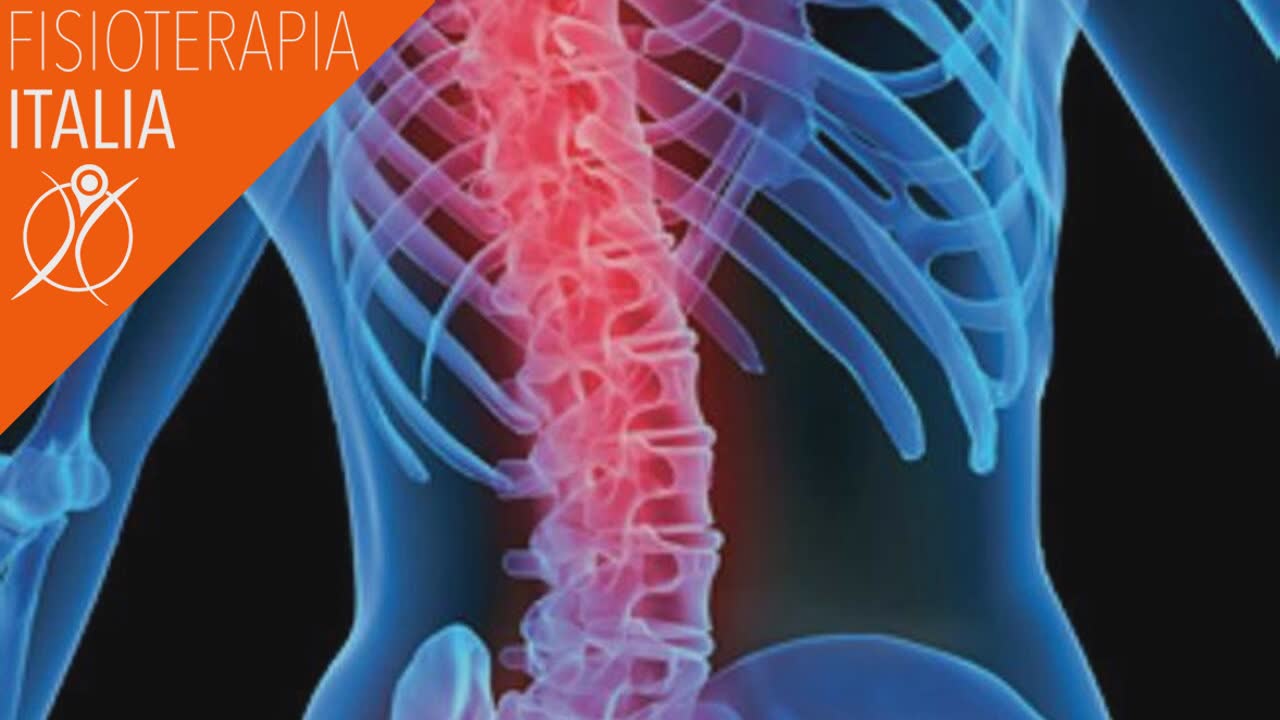 Frattura Lombare Come Trattarla Con La Fisioterapia