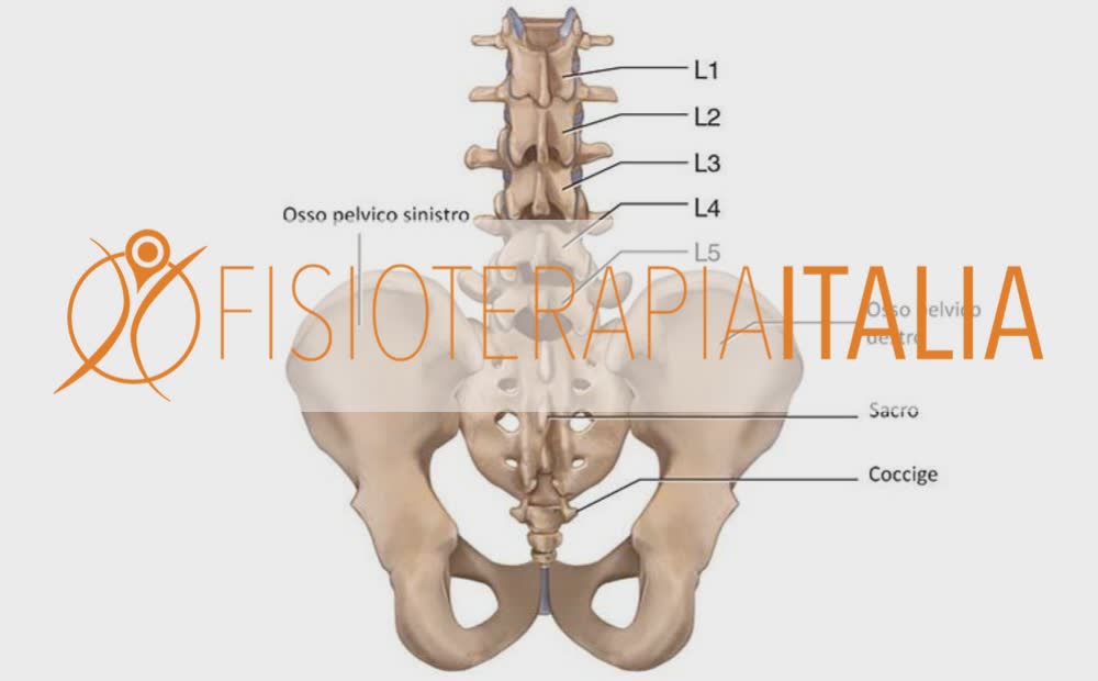 Frattura Vertebra Lombare