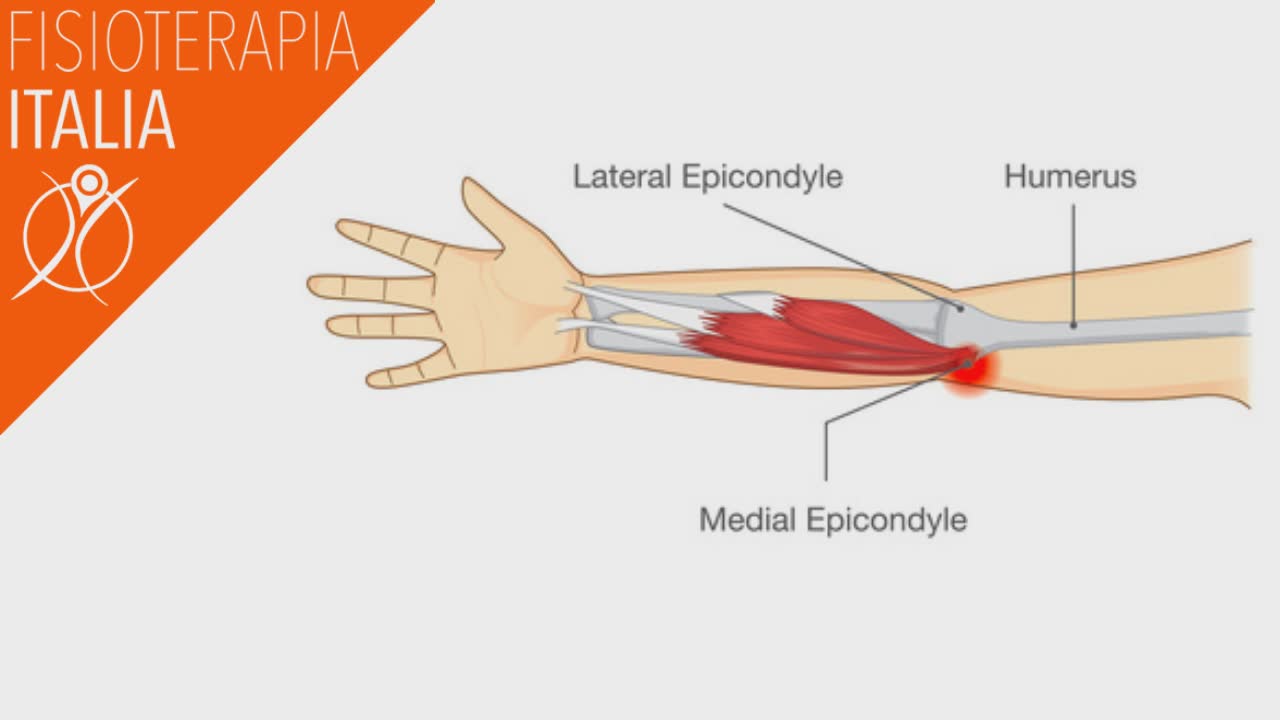 gomito epitroclea mediale