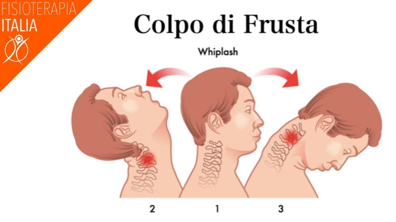 il colpo di frusta