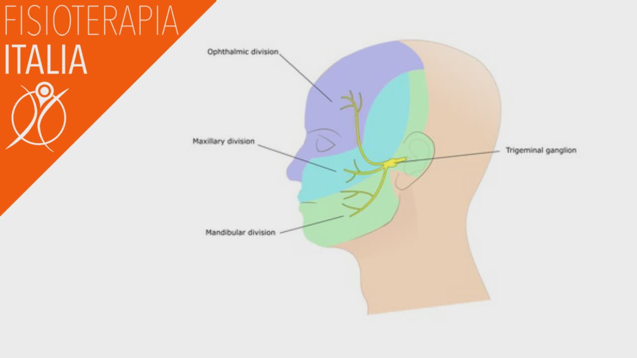 infiammazione del trigemino