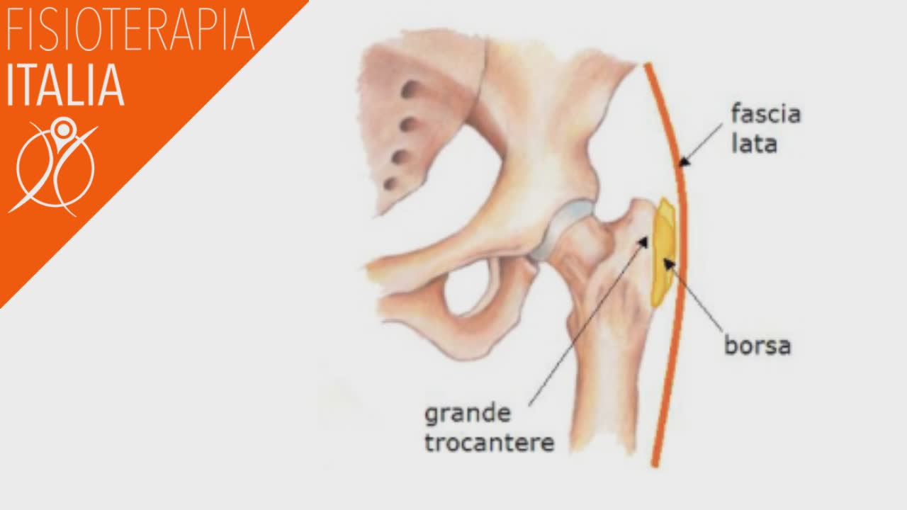 la borsite trocanterica anatomia
