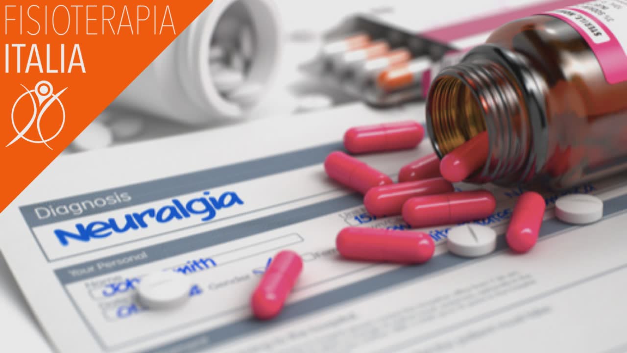 Nevralgia Del Trigemino