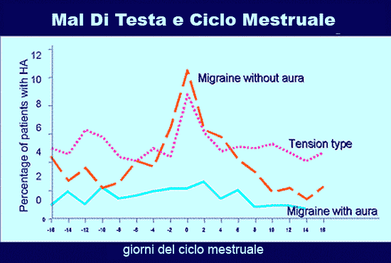 emicrania con aura