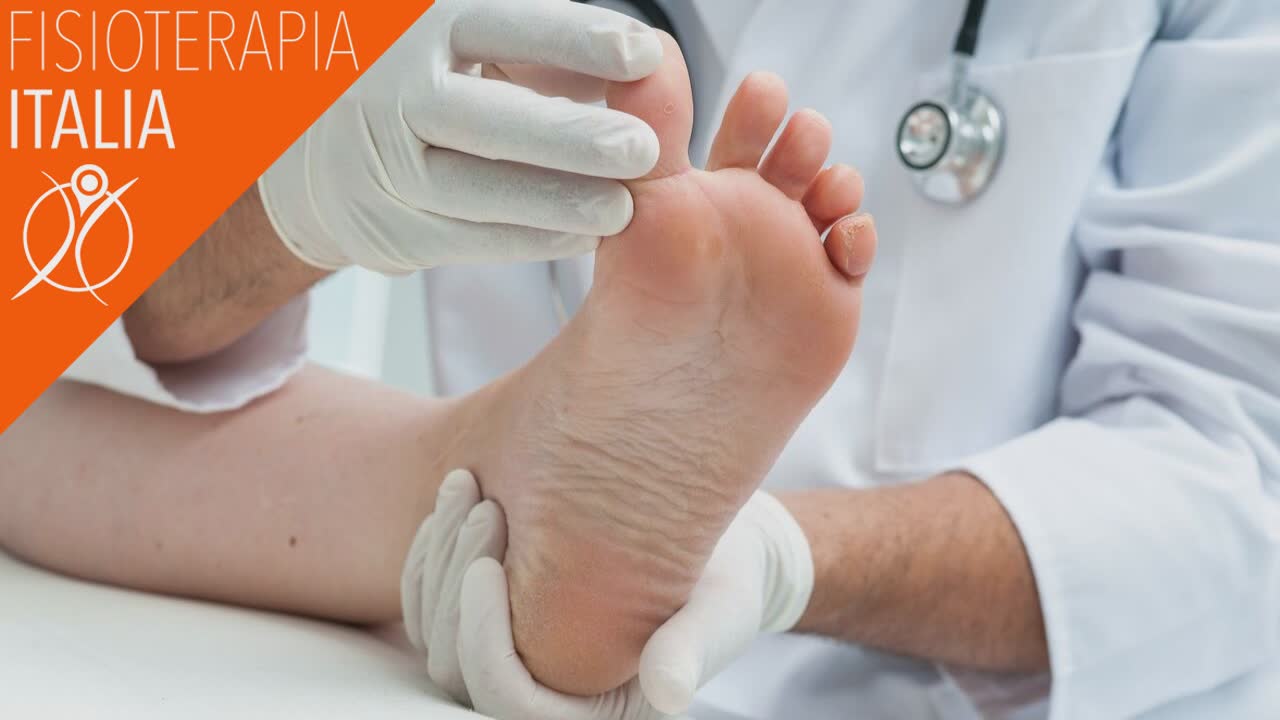 neuroma di morton cure