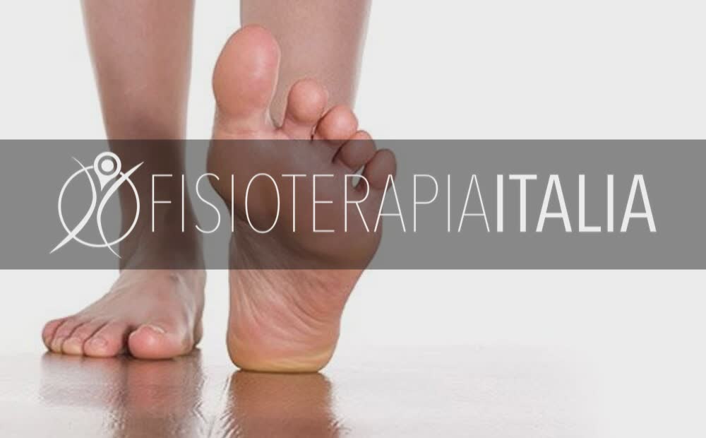 Neuroma di Morton