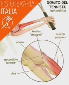 patologie del gomito