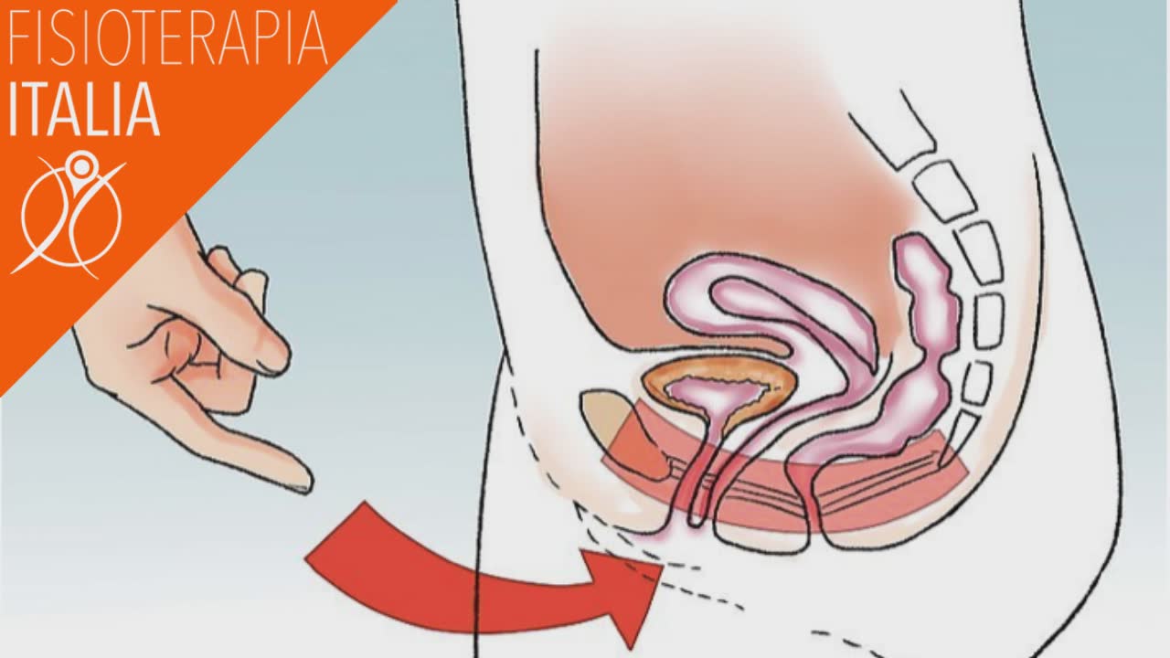 Pavimento pelvico riabilitazione con tecniche manuali