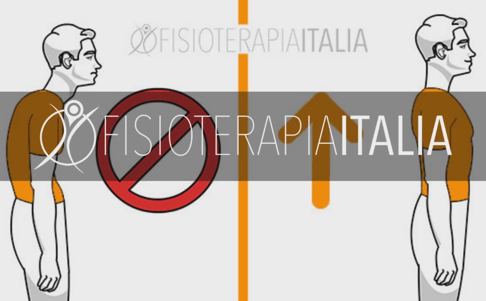 Dolori da postura