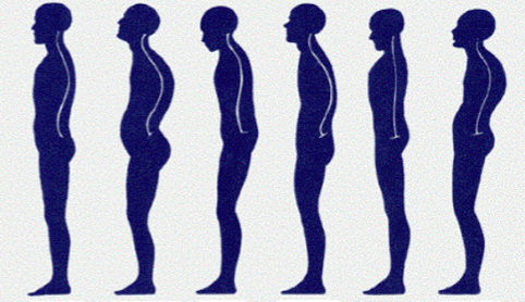 rieducazione posturale mal di schiena