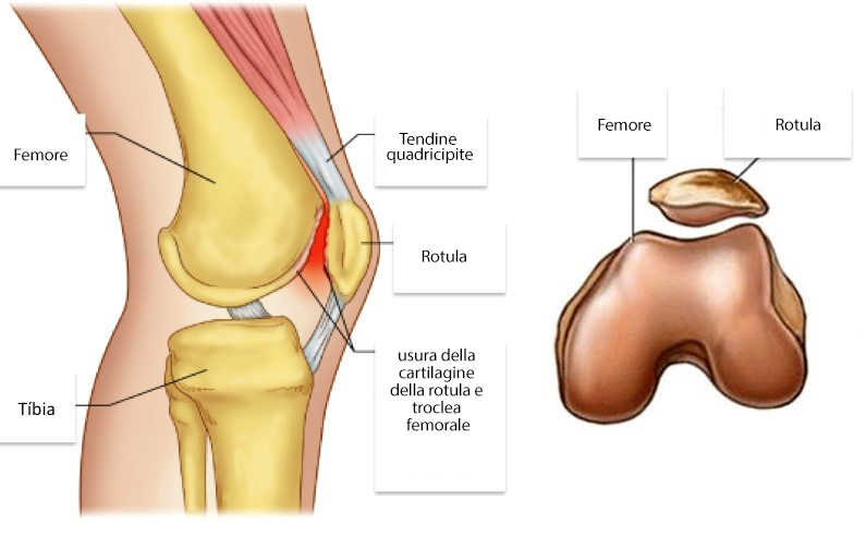 rotula ginocchio