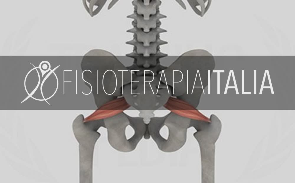 Sindrome del piriforme