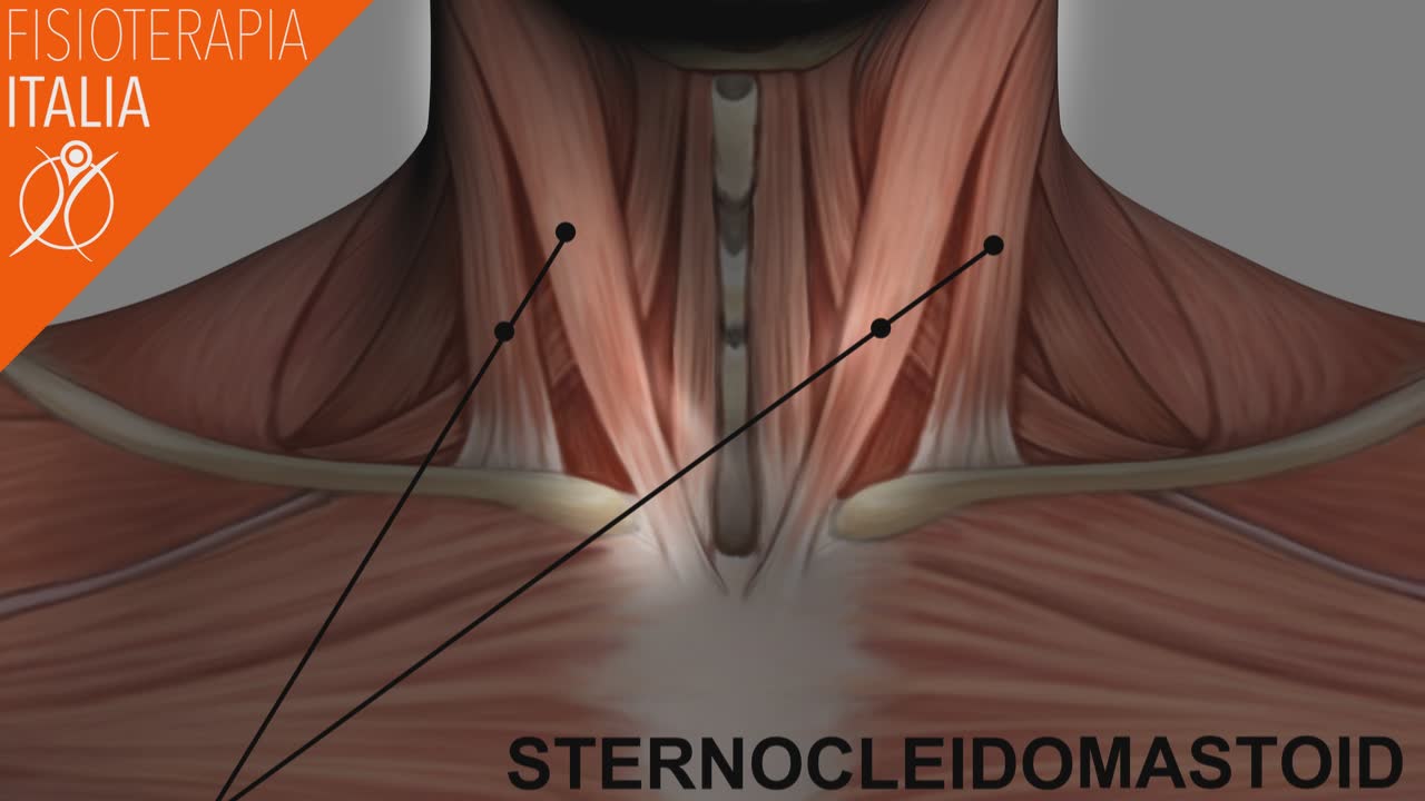 sternocleidomastoideo