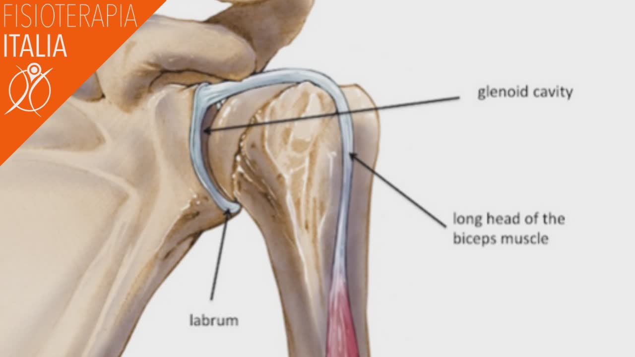 slap lesion fisioterapia